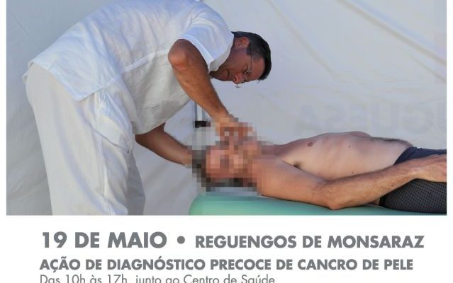 AodediagnsticoprecocedeCancrodaPele_F_0_1592558345.